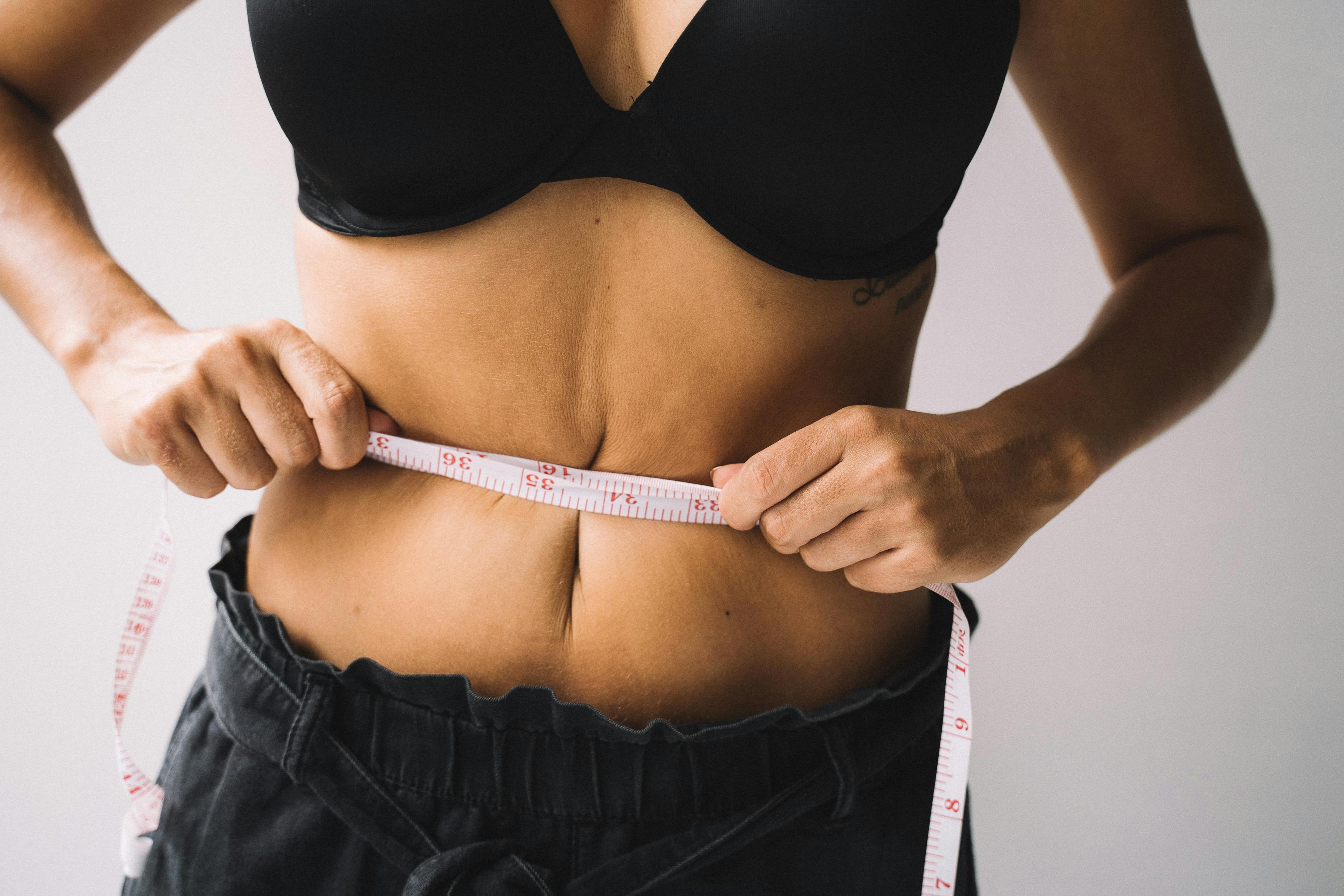 Explore 5 Proven Keto Diet Options for Effective Weight Loss in 2025!