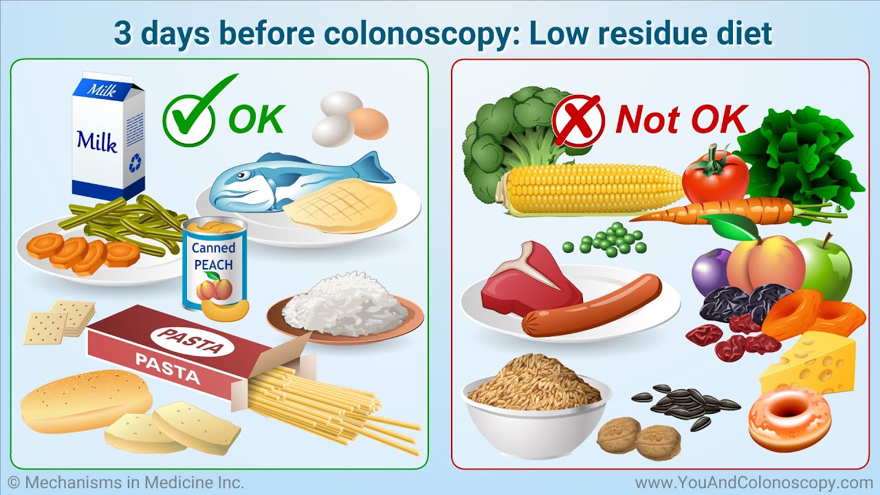 Best 5 Practical Foods for Your Colonoscopy Diet in 2025