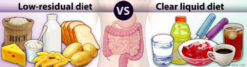 Colonoscopy liquid diet